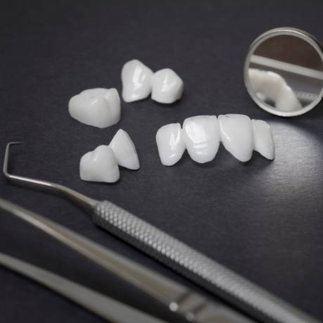 Several white dental crowns and veneers on table next to dental mirrors