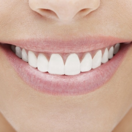 Close up of smile with straight white teeth