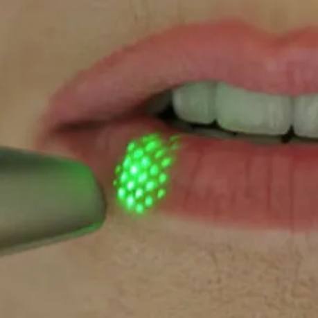 Close up of small green light being shone onto outside of lips