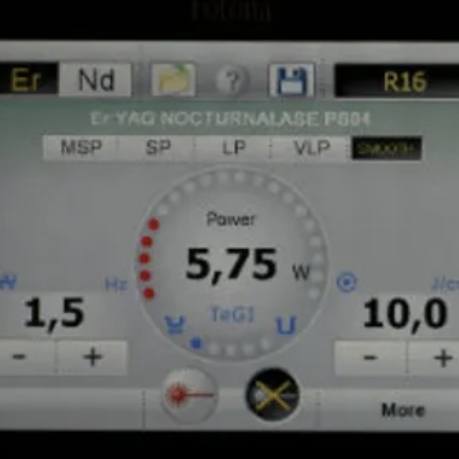 Screen showing numbers with various units like Hertz