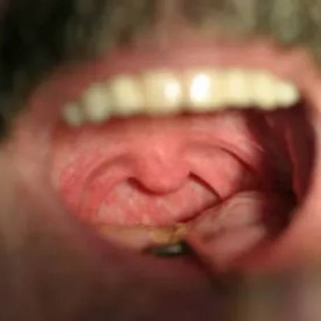 Close up of person opening their mouth wide